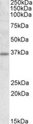 UCP2 Antibody - Uncoupling protein 2 / UCP2 antibody (1ug/ml) staining of Rat Adipose lysate (35ug protein in RIPA buffer). Primary incubation was 1 hour. Detected by chemiluminescence.