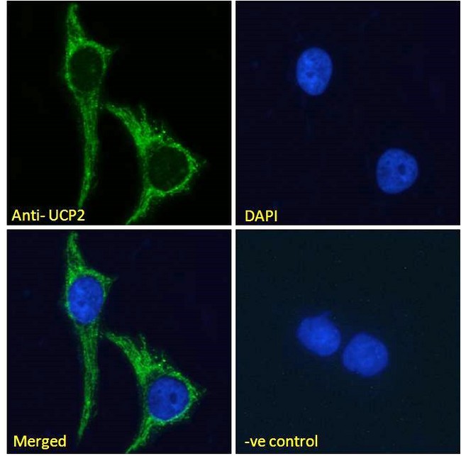 UCP2 Antibody - Uncoupling protein 2 / UCP2 antibody immunofluorescence analysis of paraformaldehyde fixed MCF7 cells, permeabilized with 0.15% Triton. Primary incubation 1hr (10ug/ml) followed by Alexa Fluor 488 secondary antibody (2ug/ml), showing Mitochondrial staining. The nuclear stain is DAPI (blue). Negative control: Unimmunized goat IgG (10ug/ml) followed by Alexa Fluor 488 secondary antibody (2ug/ml).