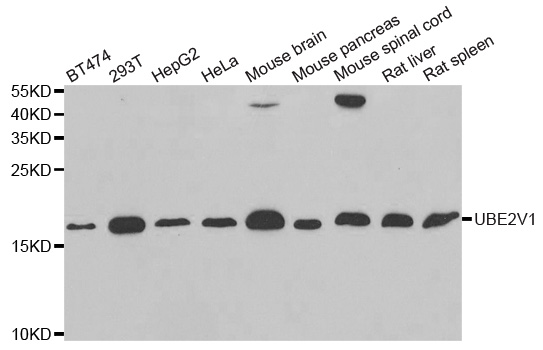 UEV1 / UEV1A Antibody - Western blot analysis of extracts of various cell lines, using UBE2V1 antibody.