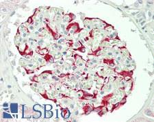 UEV1 / UEV1A Antibody - Human Kidney: Formalin-Fixed, Paraffin-Embedded (FFPE)