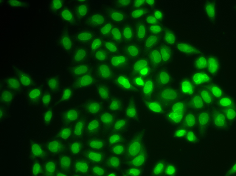 UEV1 / UEV1A Antibody - Immunofluorescence analysis of U2OS cells.