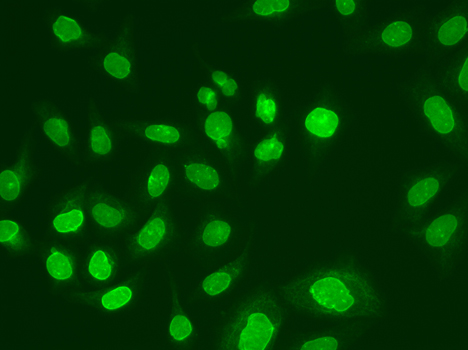 UEV1 / UEV1A Antibody - Immunofluorescence analysis of A549 cells.