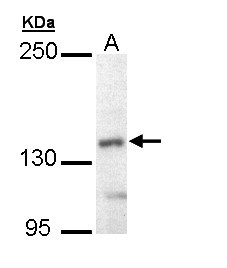 UFD2A / UBE4B Antibody - Sample (30 ug of whole cell lysate). A: Hep G2 . 5% SDS PAGE. UFD2A / UBE4B antibody diluted at 1:10000