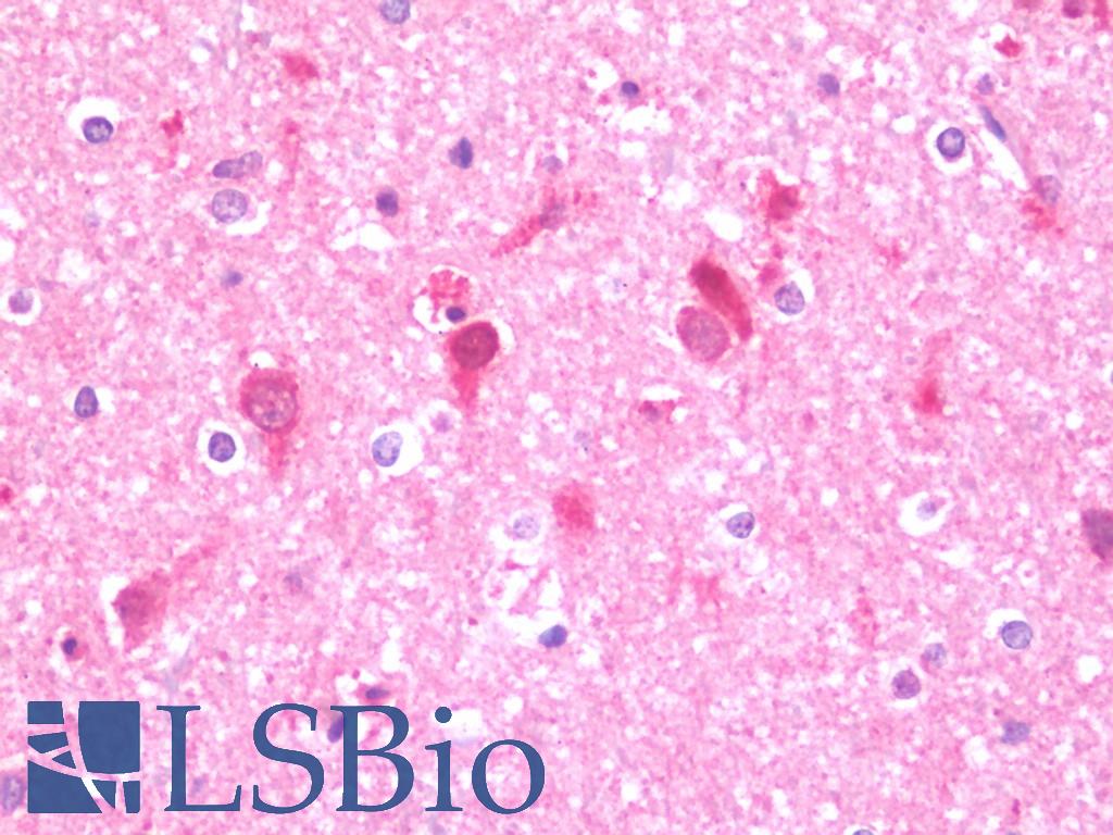 UFD2A / UBE4B Antibody - Anti-UFD2A / UBE4B antibody IHC staining of human brain, cortex. Immunohistochemistry of formalin-fixed, paraffin-embedded tissue after heat-induced antigen retrieval. Antibody concentration 7.5 ug/ml.