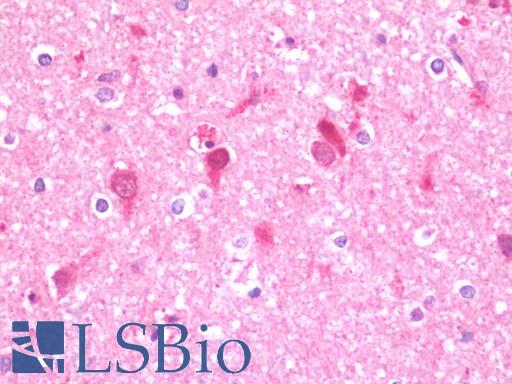 UFD2A / UBE4B Antibody - Anti-UFD2A / UBE4B antibody IHC staining of human brain, cortex. Immunohistochemistry of formalin-fixed, paraffin-embedded tissue after heat-induced antigen retrieval. Antibody concentration 7.5 ug/ml.
