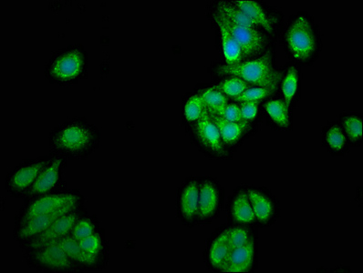 UGT1A / UGT1A1 Antibody - Immunofluorescence staining of HepG2 cells at a dilution of 1:100, counter-stained with DAPI. The cells were fixed in 4% formaldehyde, permeabilized using 0.2% Triton X-100 and blocked in 10% normal Goat Serum. The cells were then incubated with the antibody overnight at 4 °C.The secondary antibody was Alexa Fluor 488-congugated AffiniPure Goat Anti-Rabbit IgG (H+L) .