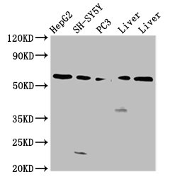 UGT1A / UGT1A1 Antibody - Positive Western Blot detected in HepG2 whole cell lysate, SH-SY5Y whole cell lysate, PC3 whole cell lysate, Rat liver tissue, Mouse liver tissue. All lanes: UGT1A1 antibody at 4.2 µg/ml Secondary Goat polyclonal to rabbit IgG at 1/50000 dilution. Predicted band size: 60, 50 KDa. Observed band size: 60 KDa