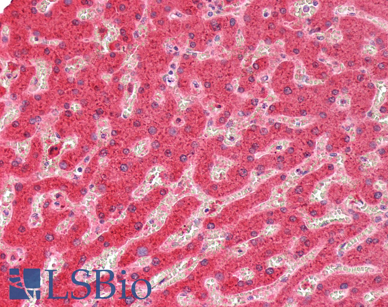 UGT1A / UGT1A1 Antibody - Human Liver: Formalin-Fixed, Paraffin-Embedded (FFPE)