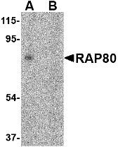 UIMC1 / RAP80 Antibody - Immunohistochemistry of RAP80 in human spleen tissue with RAP80 antibody at 2.5 µg/ml.