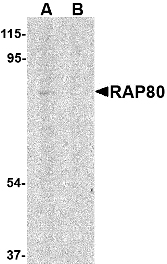 UIMC1 / RAP80 Antibody - Immunohistochemistry of RAP80 in human spleen tissue with RAP80 antibody at 2.5 µg/ml.