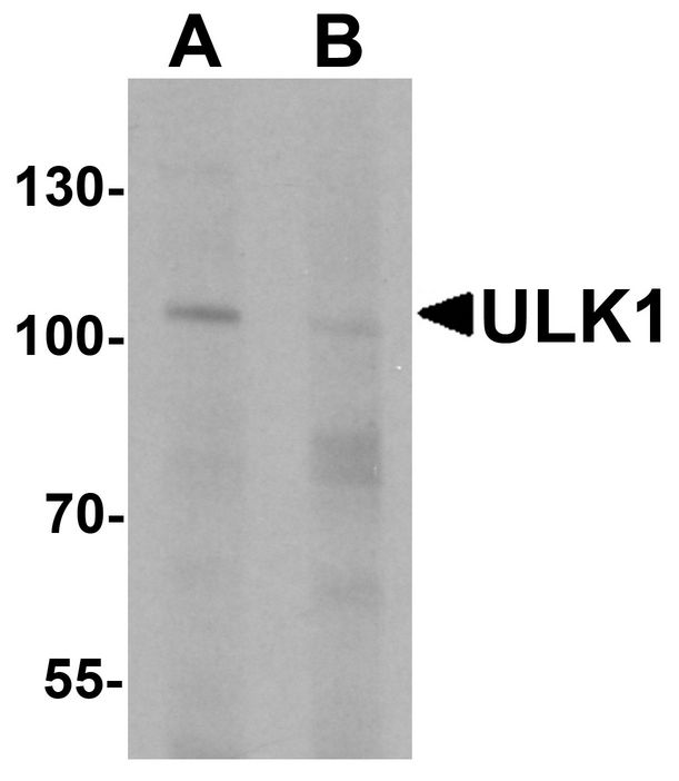 ULK1 Antibody - Western blot analysis of ULK1 in rat brain tissue lysate with ULK1 antibody at 1 ug/ml in (A) the absence and (B) the presence of blocking peptide.