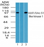 ULK1 Antibody - Western blot of ULK1 in Raji cell lysate in the 1) absence, 2) presence of immunizing peptide and 3) RAW using antibody at 2 ug/ml.