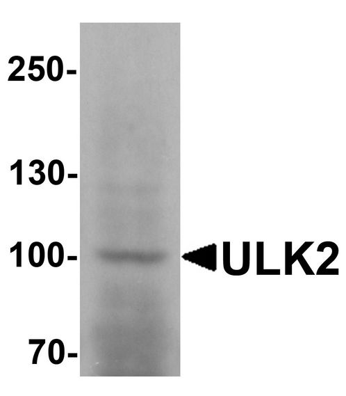 ULK2 Antibody - Western blot analysis of ULK2 in human brain tissue lysate with ULK2 antibody at 1 ug/ml.