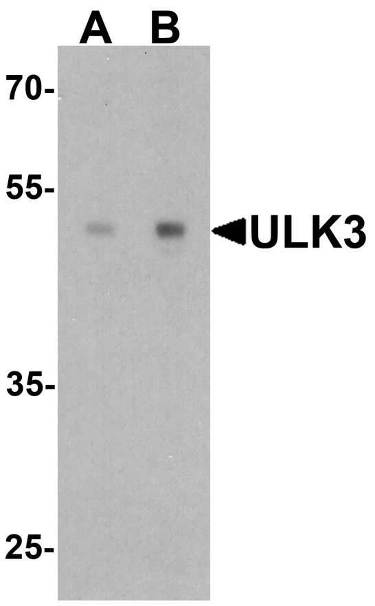 ULK3 Antibody - Western blot analysis of ULK3 in human brain tissue lysate with ULK3 antibody at (A) 0.5 and (B) 1 ug/ml.