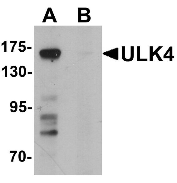 ULK4 Antibody - Western blot analysis of ULK4 in 3T3 cell lysate with ULK4 antibody at 1 ug/ml in (A) the absence and (B) the presence of blocking peptide.