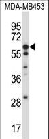 UMOD / Uromodulin Antibody - UMOD Antibody western blot of MDA-MB453 cell line lysates (35 ug/lane). The UMOD antibody detected the UMOD protein (arrow).