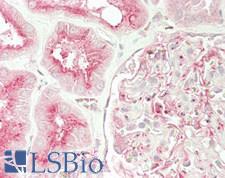 UNC13B Antibody - Human Kidney: Formalin-Fixed, Paraffin-Embedded (FFPE)