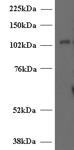 UNC13D Antibody - Goat Anti-Munc13-4 / UNC13D (Internal) Antibody (2µg/ml) staining of Human T-lymphocyte lysate (35µg protein in RIPA buffer). Detected by chemiluminescencence.