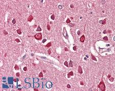 UNC5H3 / UNC5C Antibody - Anti-UNC5H3 / UNC5C antibody IHC of human brain, cortex. Immunohistochemistry of formalin-fixed, paraffin-embedded tissue after heat-induced antigen retrieval. Antibody dilution 3.75 ug/ml.