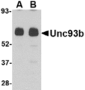 UNC93B / UNC93B1 Antibody - Western blot of Unc93b in human heart tissue lysate with Unc93b antibody at (A) 0.5 and (B) 1 ug/ml.