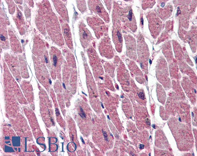 UNG / Uracil DNA Glycosylase Antibody - Anti-UNG antibody IHC of human heart. Immunohistochemistry of formalin-fixed, paraffin-embedded tissue after heat-induced antigen retrieval. Antibody concentration 10 ug/ml.