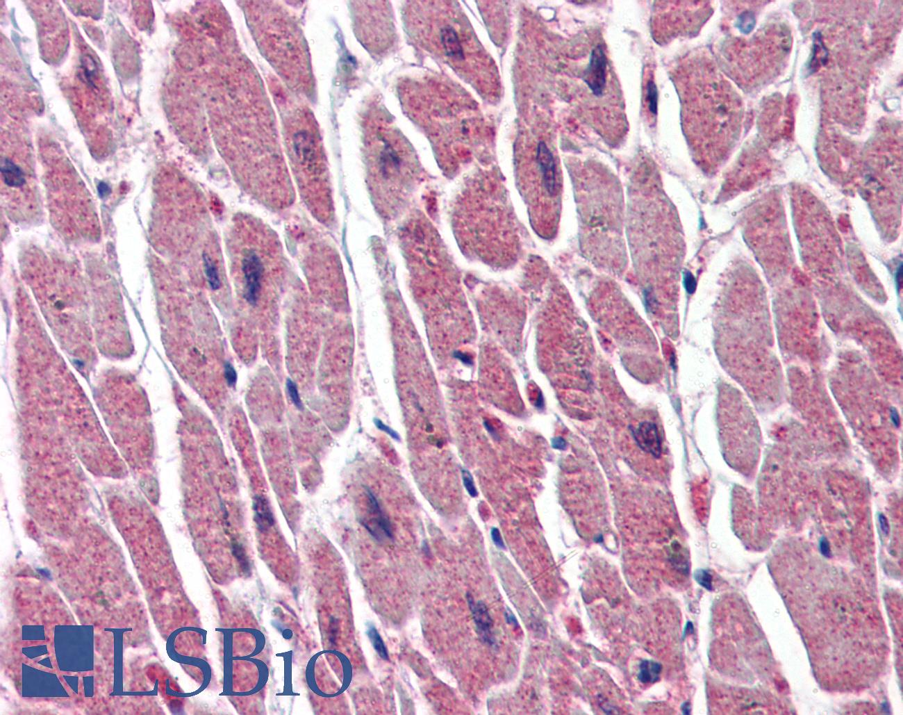 UNG / Uracil DNA Glycosylase Antibody - Anti-UNG antibody IHC of human heart. Immunohistochemistry of formalin-fixed, paraffin-embedded tissue after heat-induced antigen retrieval. Antibody concentration 10 ug/ml.