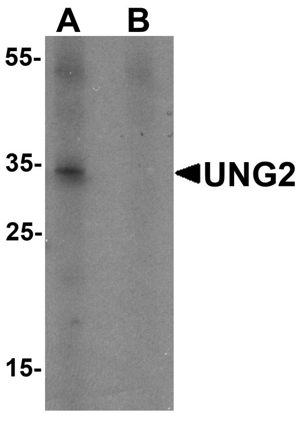 UNG / Uracil DNA Glycosylase Antibody - Western blot analysis of UNG in 3T3 cell lysate with UNG antibody at 1 ug/ml in (A) the presence and (B) the absence of blocking peptide.