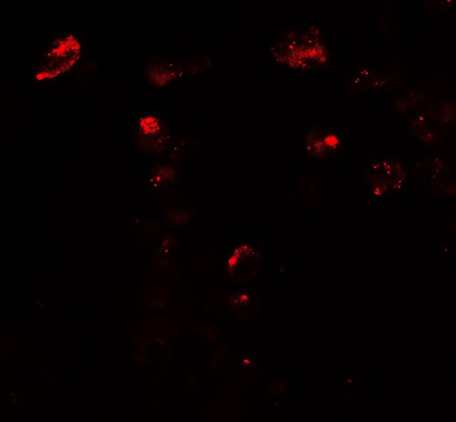 UNG / Uracil DNA Glycosylase Antibody - Immunofluorescence of UNG in 3T3 cells with UNG antibody at 20 µg/mL.
