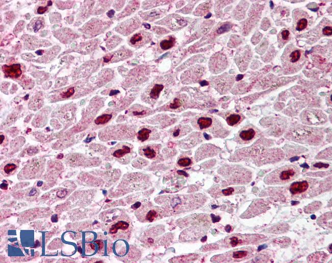 UNG / Uracil DNA Glycosylase Antibody - Anti-UNG antibody IHC of human heart. Immunohistochemistry of formalin-fixed, paraffin-embedded tissue after heat-induced antigen retrieval. Antibody concentration 5 ug/ml.