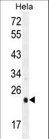 UQCRFS1 Antibody - UQCRFS1 Antibody western blot of HeLa cell line lysates (35 ug/lane). The UQCRFS1 antibody detected the UQCRFS1 protein (arrow).