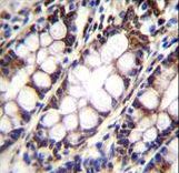 UQCRFS1 Antibody - UQCRFS1 Antibody immunohistochemistry of formalin-fixed and paraffin-embedded human rectum tissue followed by peroxidase-conjugated secondary antibody and DAB staining.