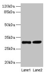 UQCRQ Antibody - Western blot All lanes: Cytochrome b-c1 complex subunit 8 antibody at 2µg/ml Lane 1: EC109 whole cell lysate Lane 2: 293T whole cell lysate Secondary Goat polyclonal to rabbit IgG at 1/15000 dilution Predicted band size: 9.5 kDa Observed band size: 30 kDa