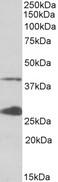 UROD Antibody - UROD antibody (0.1 ug/ml) staining of K562 lysate (35 ug protein in RIPA buffer). Primary incubation was 1 hour. Detected by chemiluminescence.