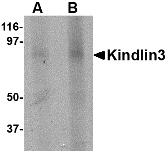 URP2 / FERMT3 Antibody - Western blot of KINDLIN3 in rat spleen lysate with KINDLIN3 antibody at (A) 1 and (B) 2 ug/ml.