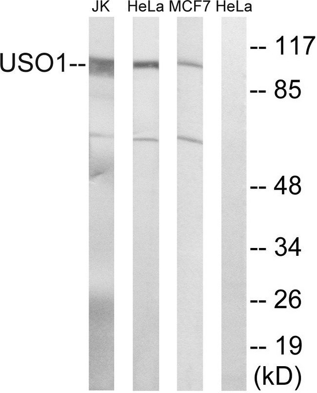 US01 / p115 Antibody - Western blot analysis of lysates from MCF-7, HeLa, and Jurkat cells, using USO1 Antibody. The lane on the right is blocked with the synthesized peptide.