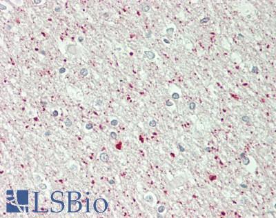 USP10 Antibody - Human Brain, Cortex, White Matter: Formalin-Fixed, Paraffin-Embedded (FFPE)