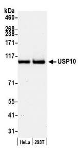 USP10 Antibody - Detection of human USP10 by western blot. Samples: Whole cell lysate (50 µg) from HeLa and HEK293T cells prepared using NETN lysis buffer. Antibody: Affinity purified rabbit anti-USP10 antibody used for WB at 0.1 µg/ml. Detection: Chemiluminescence with an exposure time of 30 seconds.
