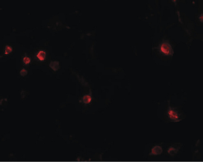 USP10 Antibody - Immunofluorescence of USP10 in Jurkat cells with USP10 antibody at 20 ug/ml.