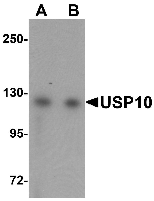 USP10 Antibody - Western blot analysis of USP10 in Jurkat cell lysate with USP10 antibody at (A) 1 and (B) 2 ug/ml.
