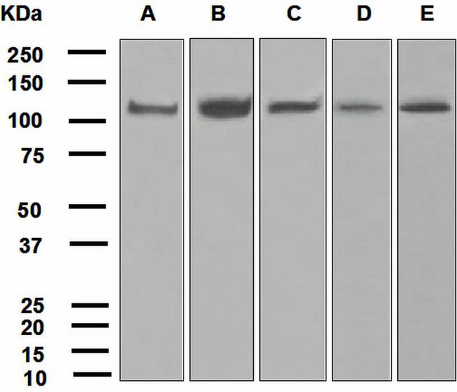 USP11 Antibody - Western blot analysis on (A) 293T, (B) Jurkat, (C) human testis, (D) fetal kidney, and (E) LnCaP cell lysates using anti-USP11 antibody.