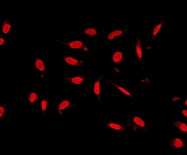USP11 Antibody - Immunofluorescent staining of HeLa cells using anti-USP11 antibody.