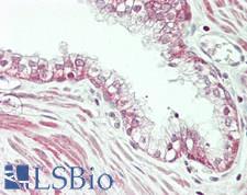 USP14 Antibody - Human Prostate: Formalin-Fixed, Paraffin-Embedded (FFPE)