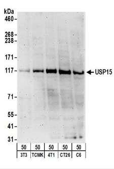 USP15 Antibody - Detection of Mouse and Rat USP15 by Western Blot. Samples: Whole cell lysate (50 ug) from NIH3T3, TCMK-1, 4T1, CT26.WT, and rat C6 cells. Antibodies: Affinity purified rabbit anti-USP15 antibody used for WB at 1 ug/ml. Detection: Chemiluminescence with an exposure time of 3 minutes.