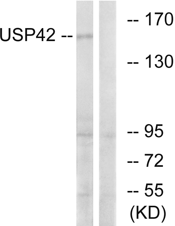 USP42 Antibody - Western blot analysis of lysates from HT-29 cells, using USP42 Antibody. The lane on the right is blocked with the synthesized peptide.