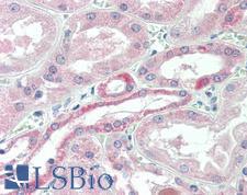 USP43 Antibody - Anti-USP43 antibody IHC staining of human kidney. Immunohistochemistry of formalin-fixed, paraffin-embedded tissue after heat-induced antigen retrieval.