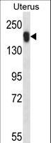 USP43 Antibody - USP43 Antibody western blot of human normal Uterus tissue lysates (35 ug/lane). The USP43 antibody detected the USP43 protein (arrow).