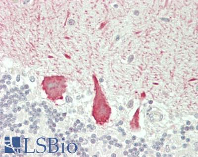 USP43 Antibody - Human Brain, Cerebellum: Formalin-Fixed, Paraffin-Embedded (FFPE)