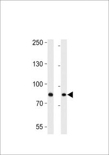 USP51 Antibody - USP51 Antibody western blot of HepG2,MCF-7 cell line lysates (35 ug/lane). The USP51 antibody detected the USP51 protein (arrow).