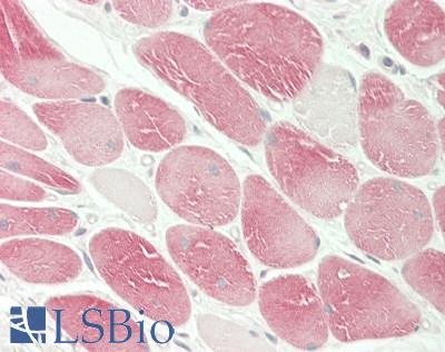 USP53 Antibody - Human Tonsil, Myocytes: Formalin-Fixed, Paraffin-Embedded (FFPE)