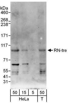 USP6NL Antibody - Detection of Human RN-tre by Western Blot. Samples: Whole cell lysate from HeLa (5, 15 and 50 ug) and 293T (T; 50 ug) cells. Antibody: Affinity purified rabbit anti-RN-tre antibody used at 0.4 ug/ml. Detection: Chemiluminescence with an exposure time of 3 minutes.